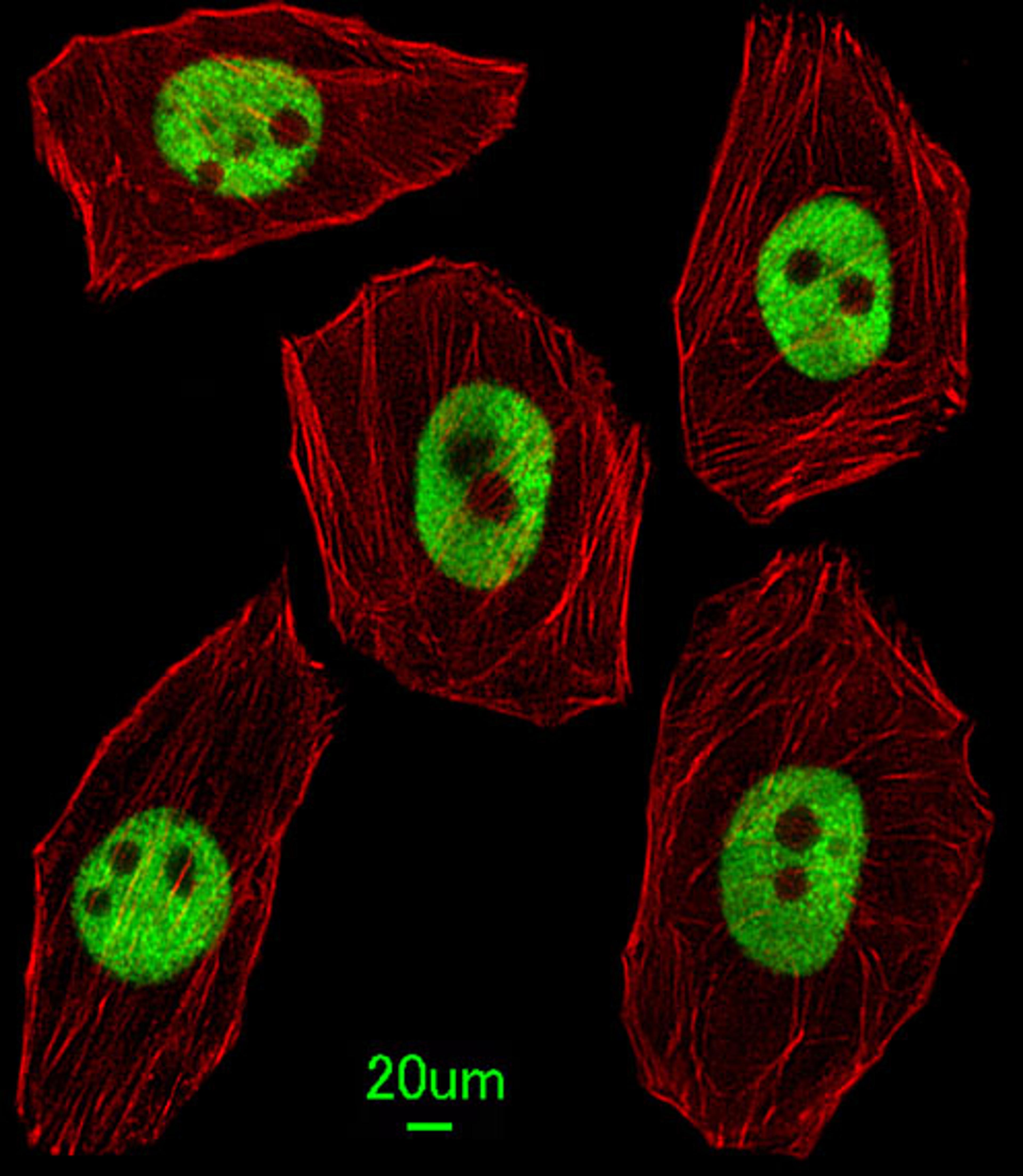 Immunofluorescent analysis of U251 cells, using UNCX Antibody . Antibody was diluted at 1:25 dilution. Alexa Fluor 488-conjugated goat anti-rabbit lgG at 1:400 dilution was used as the secondary antibody (green). Cytoplasmic actin was counterstained with 