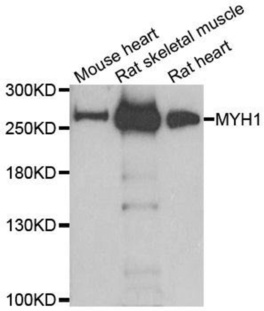 Western blot analysis of extracts of various cell lines using MYH1 antibody