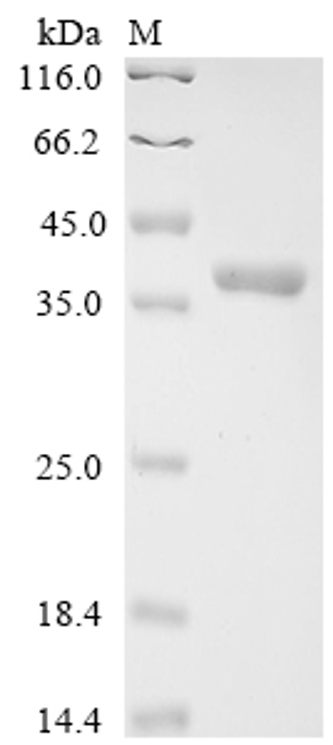 (Tris-Glycine gel) Discontinuous SDS-PAGE (reduced) with 5% enrichment gel and 15% separation gel.