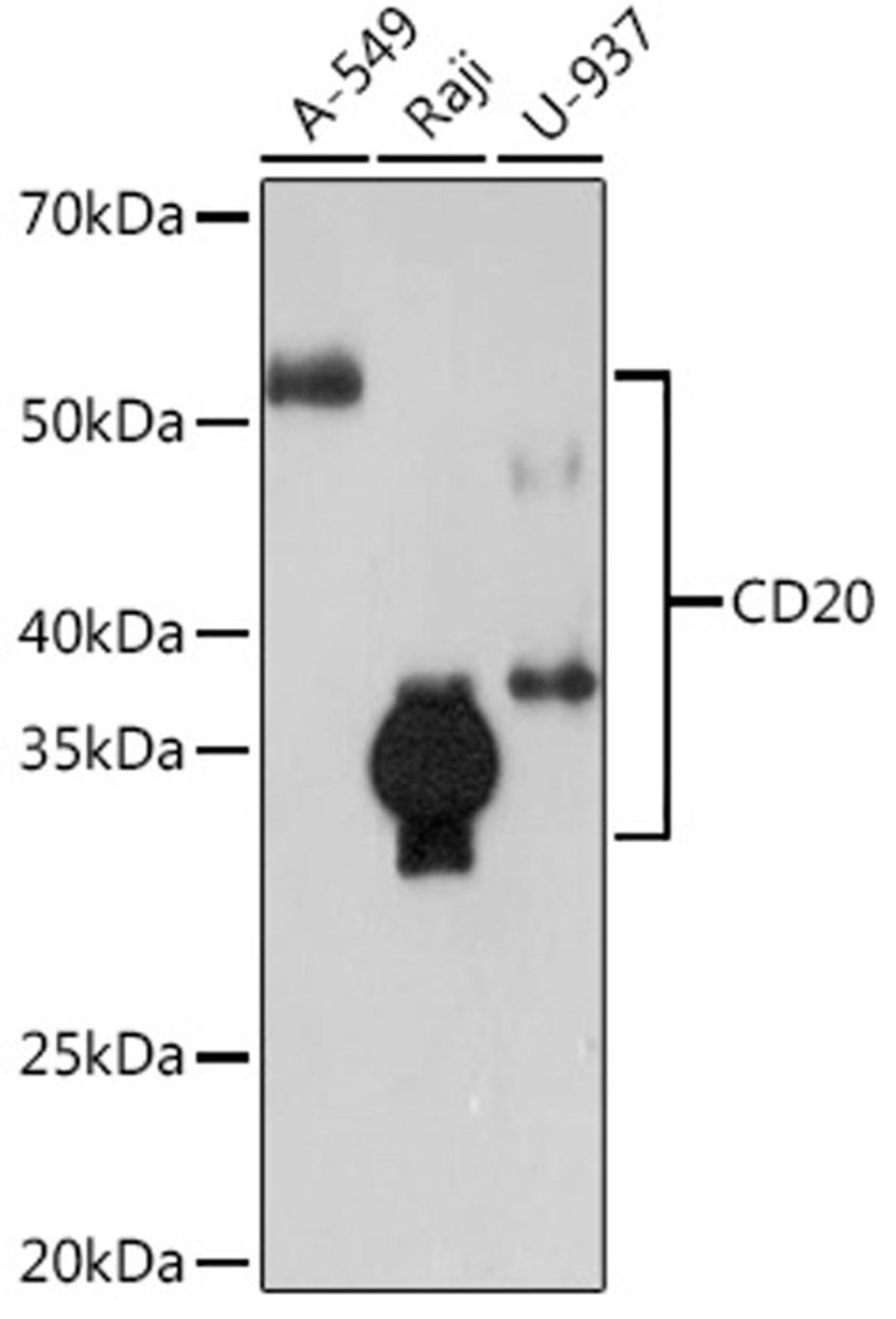 Western blot - CD20 Rabbit mAb (A4893)