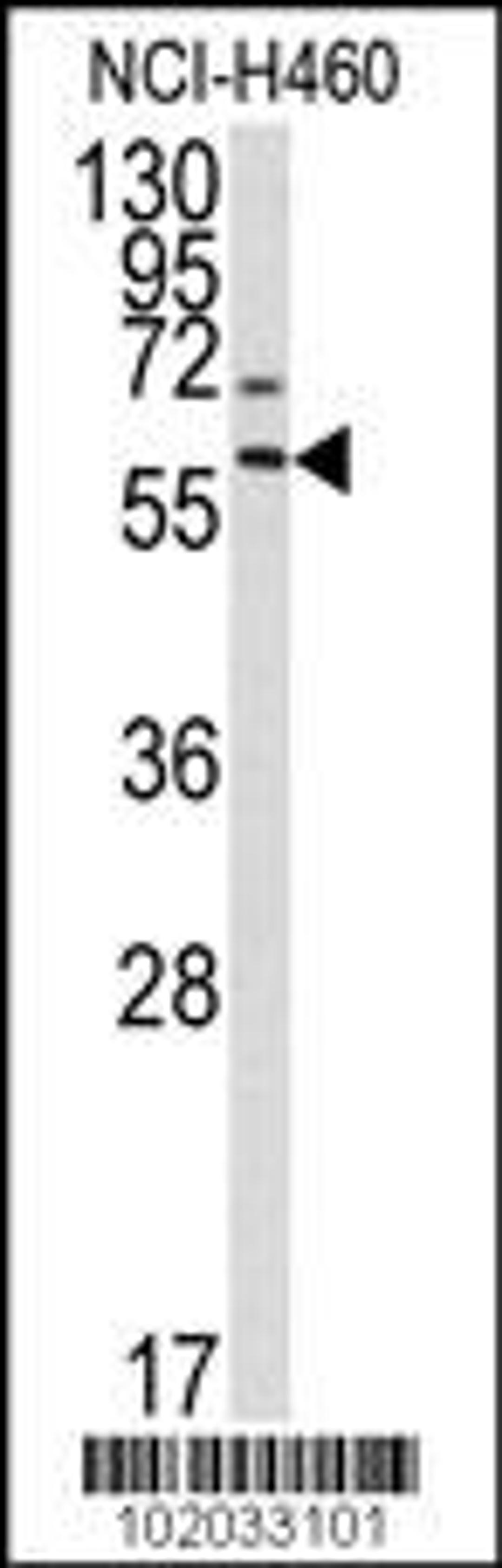 Western blot analysis of anti-MMP17 Antibody in NCI-H460 cell line lysates (35ug/lane).