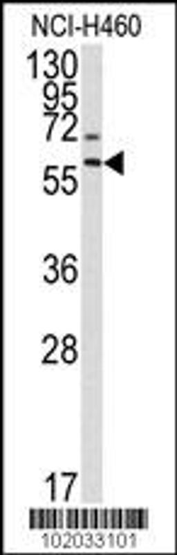 Western blot analysis of anti-MMP17 Antibody in NCI-H460 cell line lysates (35ug/lane).