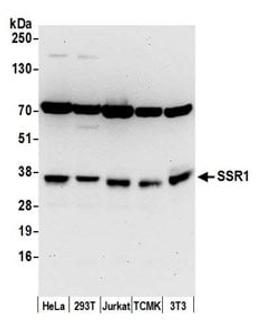 Detection of human and mouse SSR1 by western blot.