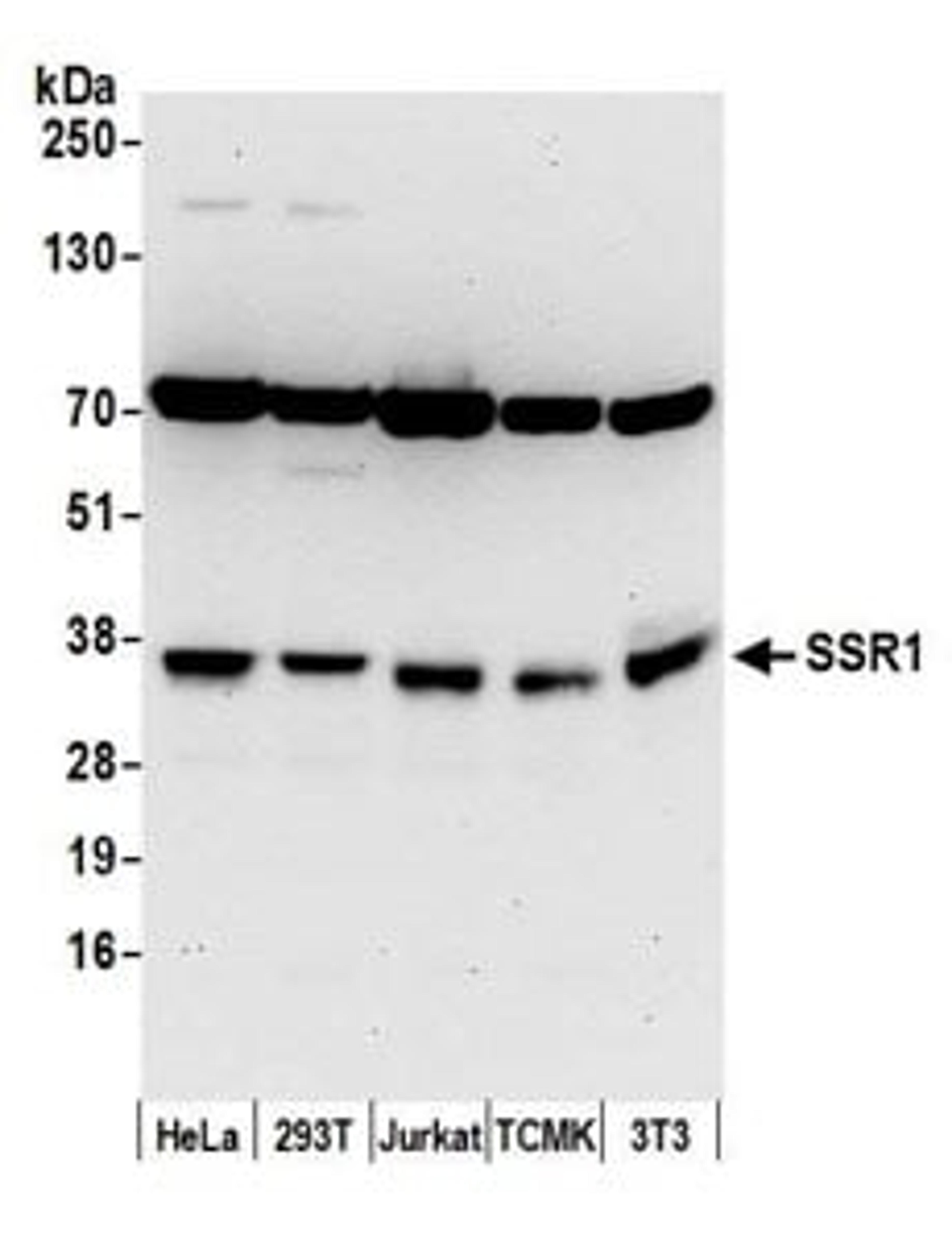 Detection of human and mouse SSR1 by western blot.