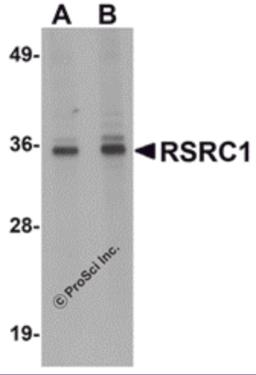 Western blot analysis of RSRC1 in HepG2 cell lysate with RSRC1 antibody at (A) 1 and (B) 2 &#956;g/mL.