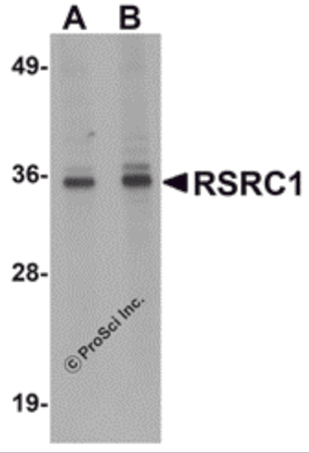 Western blot analysis of RSRC1 in HepG2 cell lysate with RSRC1 antibody at (A) 1 and (B) 2 μg/mL.