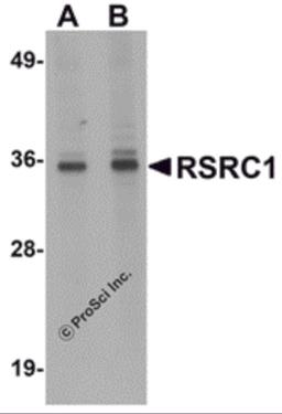 Western blot analysis of RSRC1 in HepG2 cell lysate with RSRC1 antibody at (A) 1 and (B) 2 μg/mL.