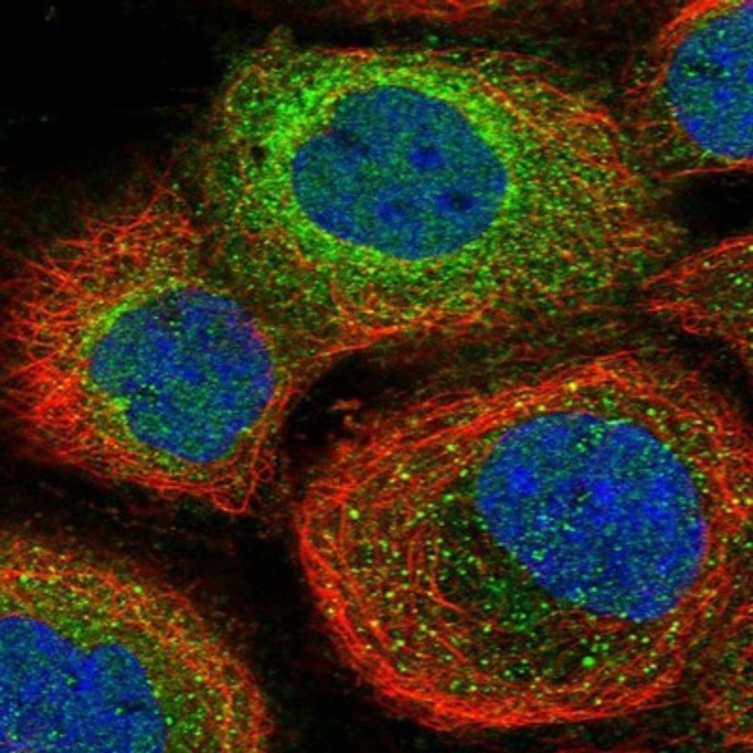 Immunocytochemistry/Immunofluorescence: PAD3 Antibody [NBP1-92240] - Staining of human cell line A-431 shows positivity in cytoplasm.