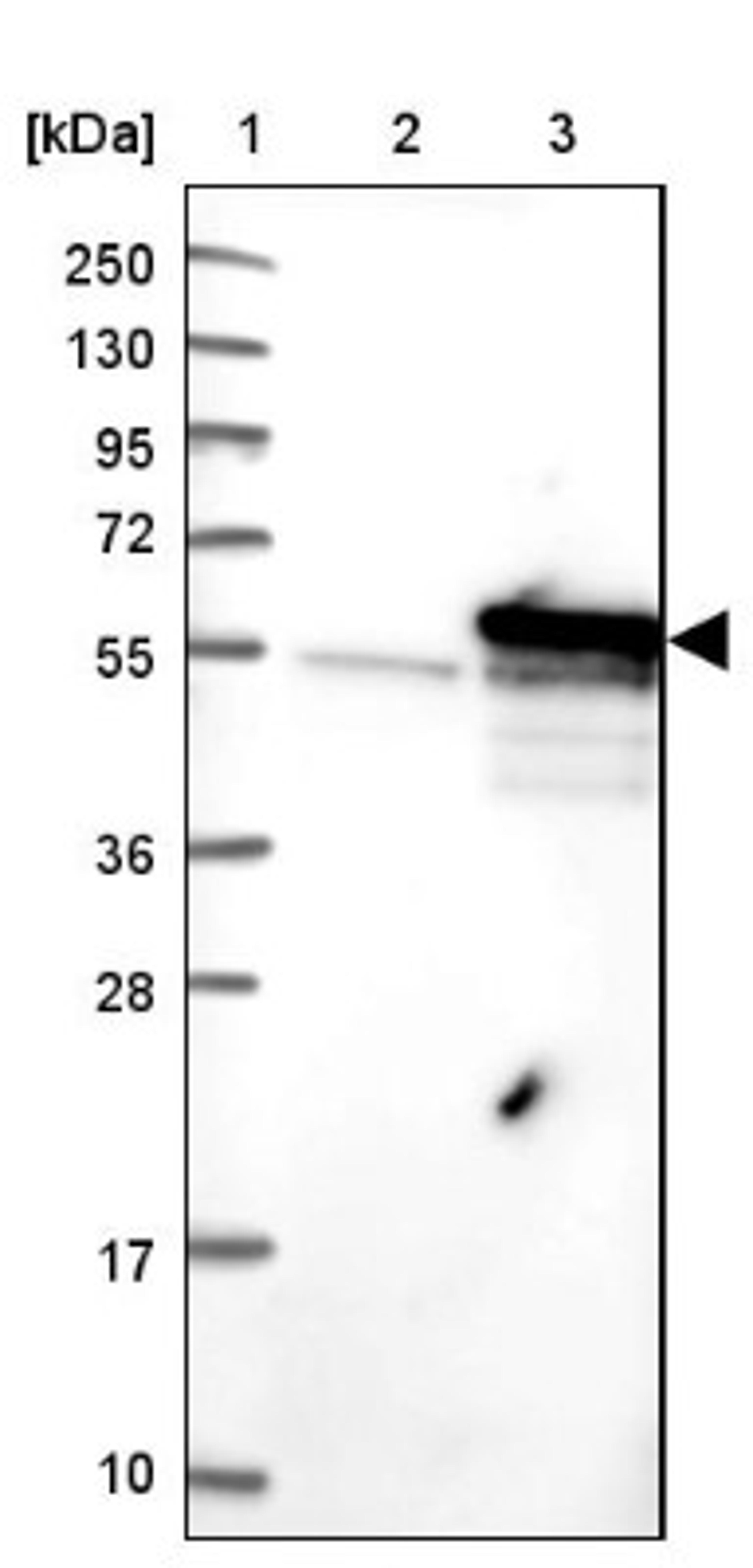 Western Blot: S5a/Angiocidin Antibody [NBP2-37888] - Lane 1: Marker [kDa] 250, 130, 95, 72, 55, 36, 28, 17, 10<br/>Lane 2: Negative Control<br/>Lane 3: LY400997