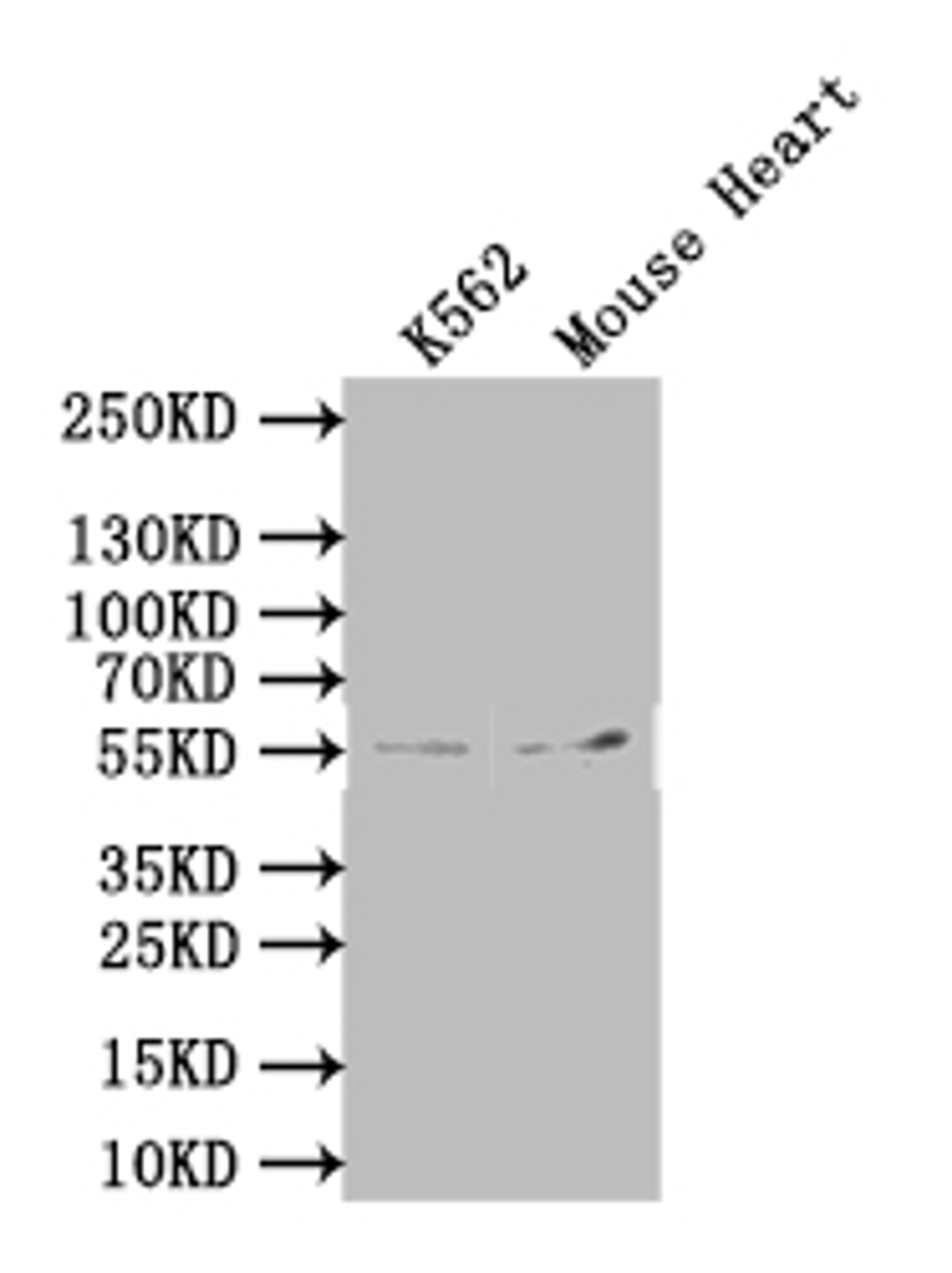 Western Blot. Positive WB detected in: Mouse heart tissue. All lanes: SLC7A6 antibody at 3ug/ml. Secondary. Goat polyclonal to rabbit IgG at 1/50000 dilution. Predicted band size: 57 kDa. Observed band size: 57 kDa.