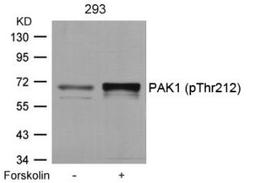 Western blot analysis of lysed extracts from 293 cells untreated or treated with forskolin using PAK1 (Phospho-Thr212).