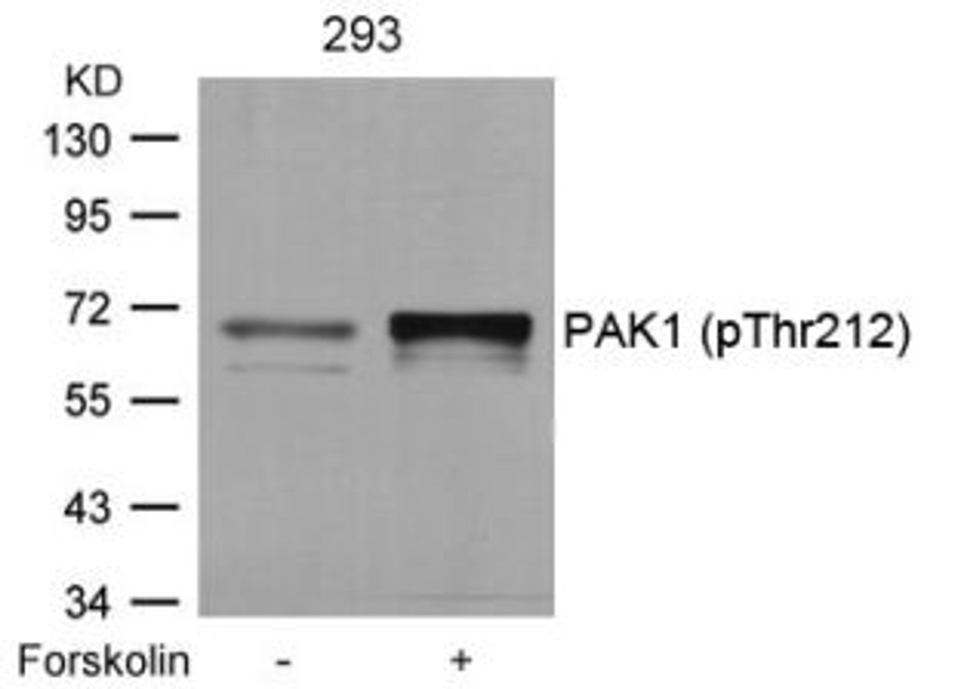 Western blot analysis of lysed extracts from 293 cells untreated or treated with forskolin using PAK1 (Phospho-Thr212).