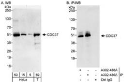 Detection of human CDC37 by western blot and immunoprecipitation.