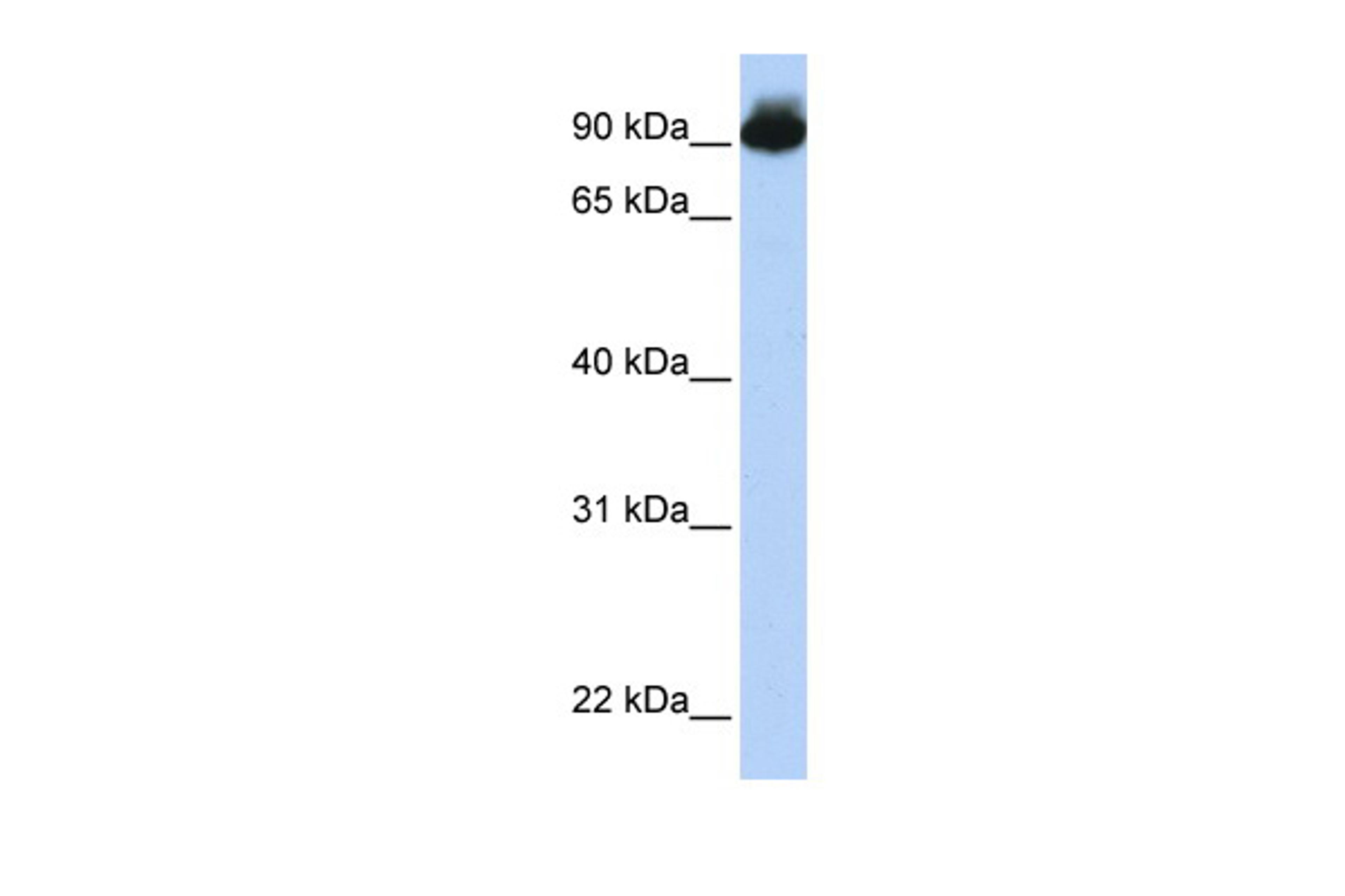 Antibody used in WB on Human 721_B at 0.2-1 ug/ml.