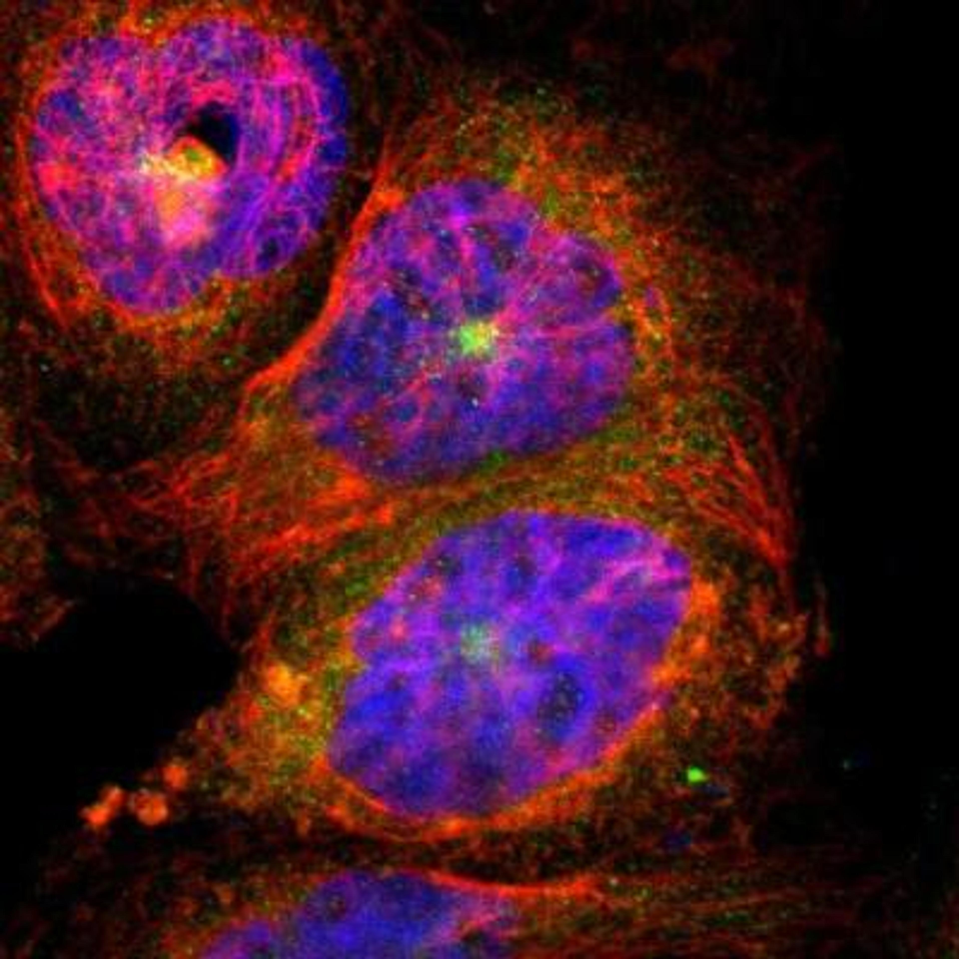 Immunocytochemistry/Immunofluorescence: DLG7/HURP Antibody [NBP1-87976] - Analysis of human cell line A-431 shows positivity in cytoplasm & microtubule organizing center. Antibody staining is shown in green.