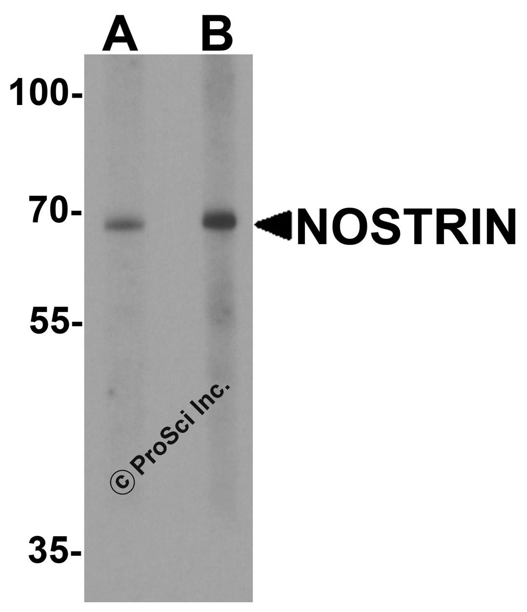 Western blot analysis of NOSTRIN in SW480 cell lysate with NOSTRIN antibody at (A) 1 and (B) 2 μg/ml.