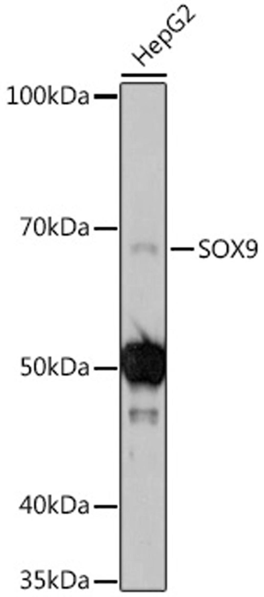 Western blot - SOX9 antibody (A2479)