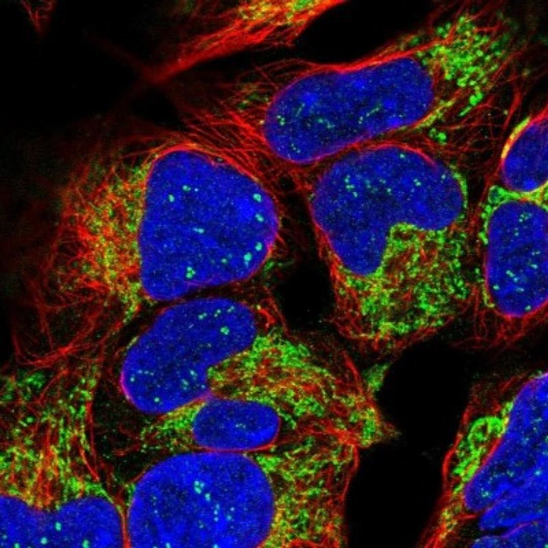 Immunocytochemistry/Immunofluorescence: TIMM13 Antibody [NBP2-13431] - Staining of human cell line HEK 293 shows positivity in nucleoli & mitochondria.