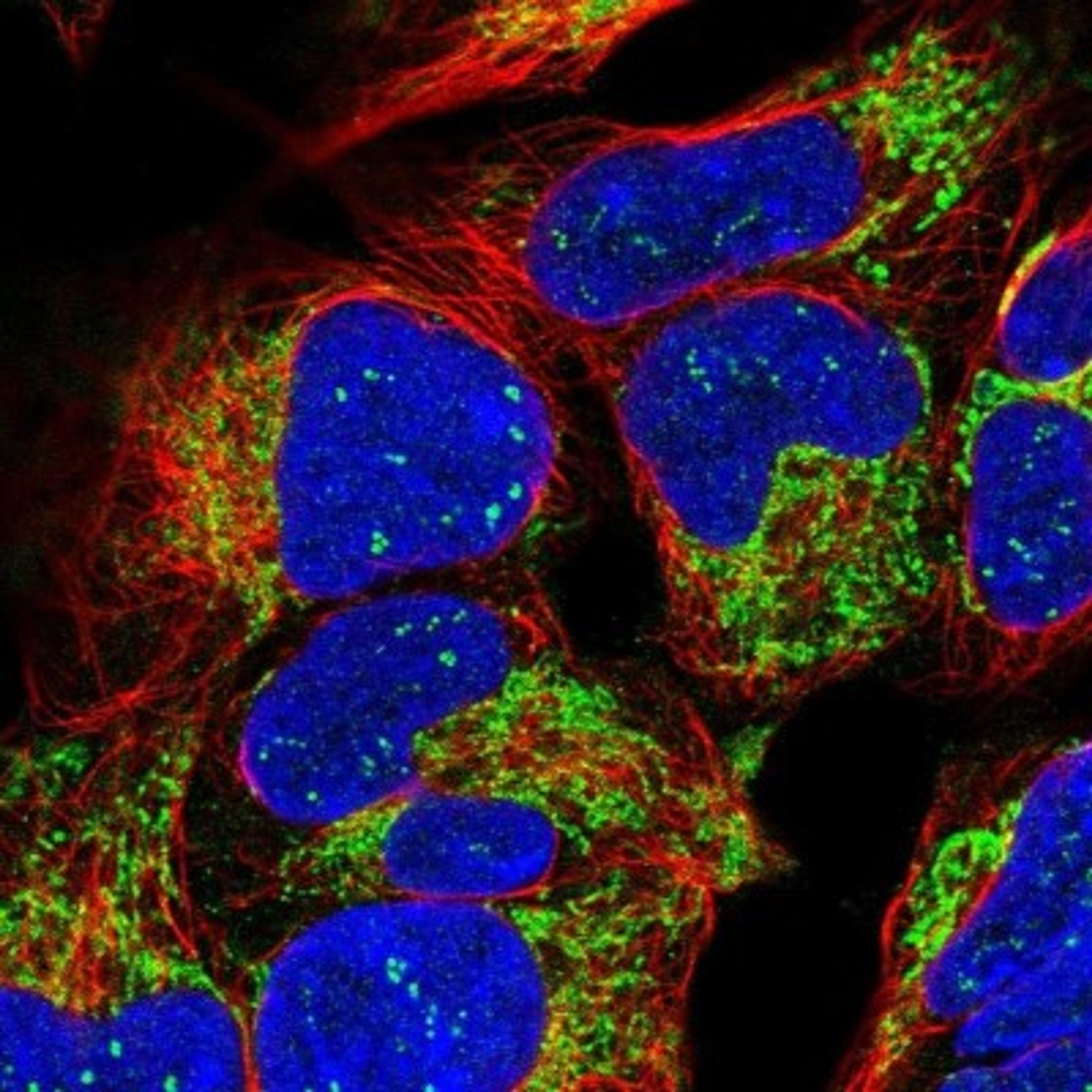 Immunocytochemistry/Immunofluorescence: TIMM13 Antibody [NBP2-13431] - Staining of human cell line HEK 293 shows positivity in nucleoli & mitochondria.