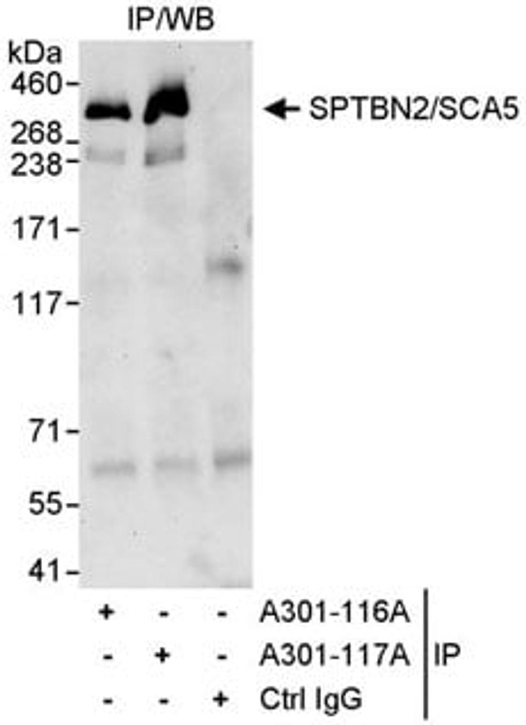 Detection of human SPTBN2/SCA5 by western blot of immunoprecipitates.