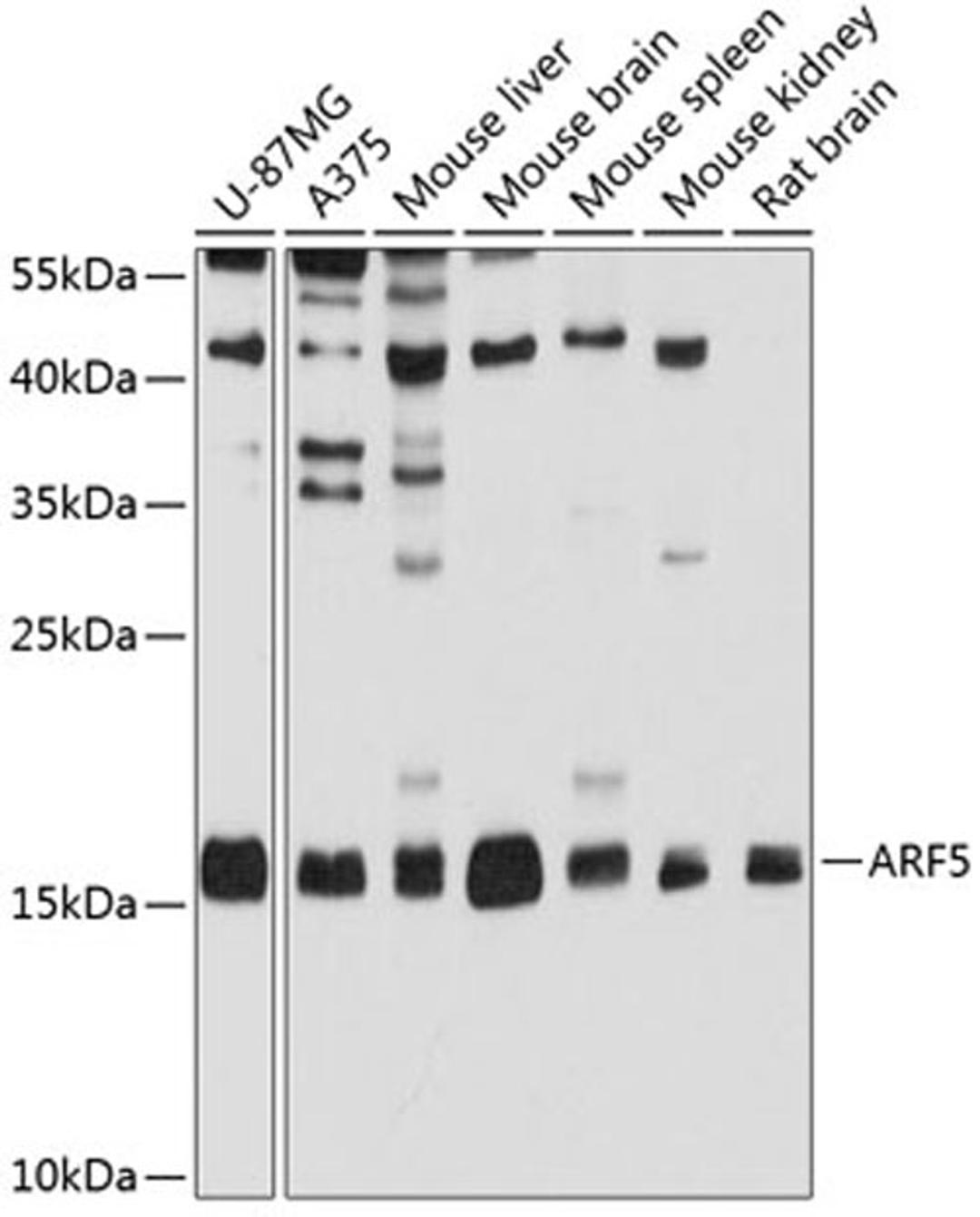 Western blot - ARF5 antibody (A3737)