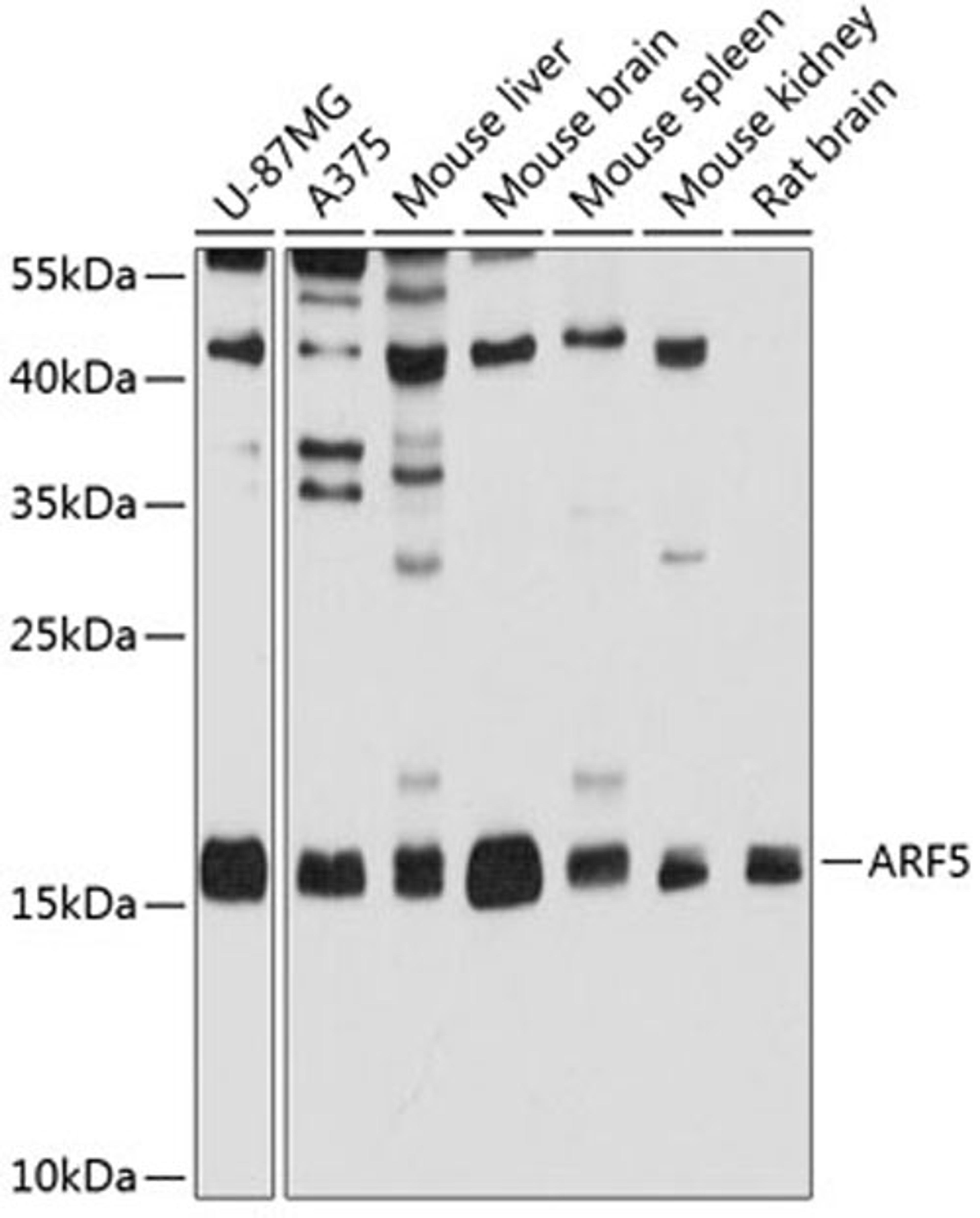 Western blot - ARF5 antibody (A3737)
