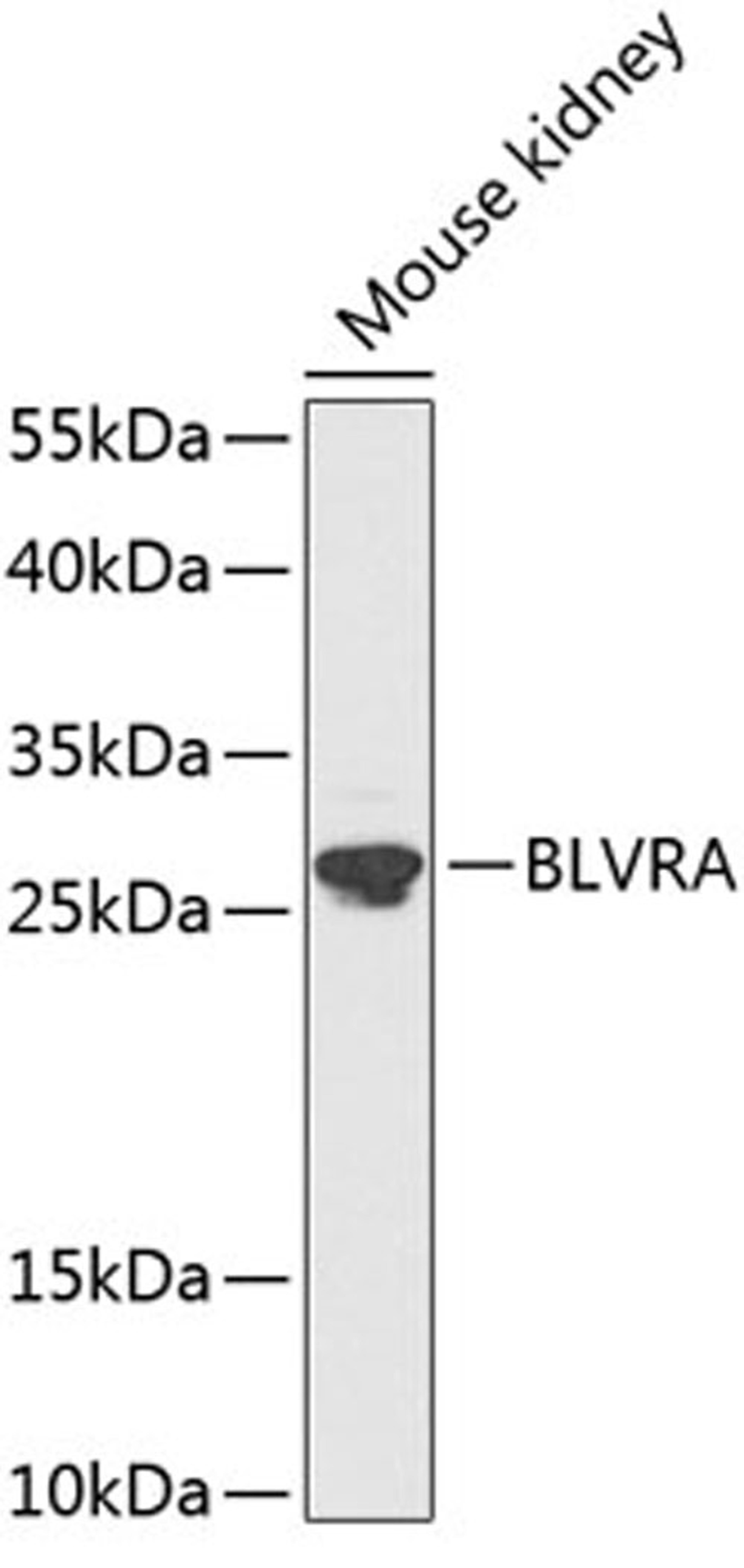 Western blot - BLVRA antibody (A3765)