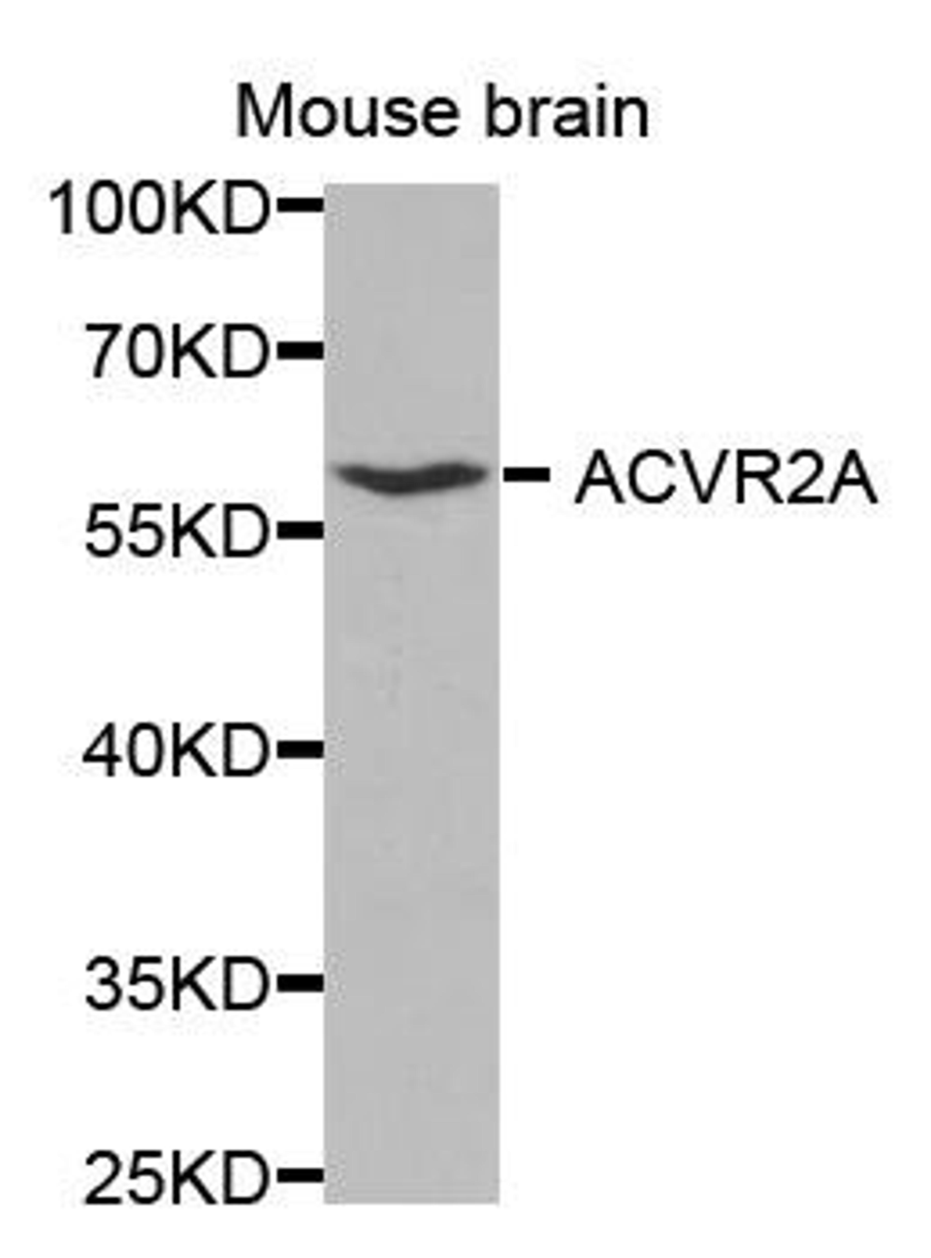 Western blot analysis of extracts of mouse brain using ACVR2A antibody