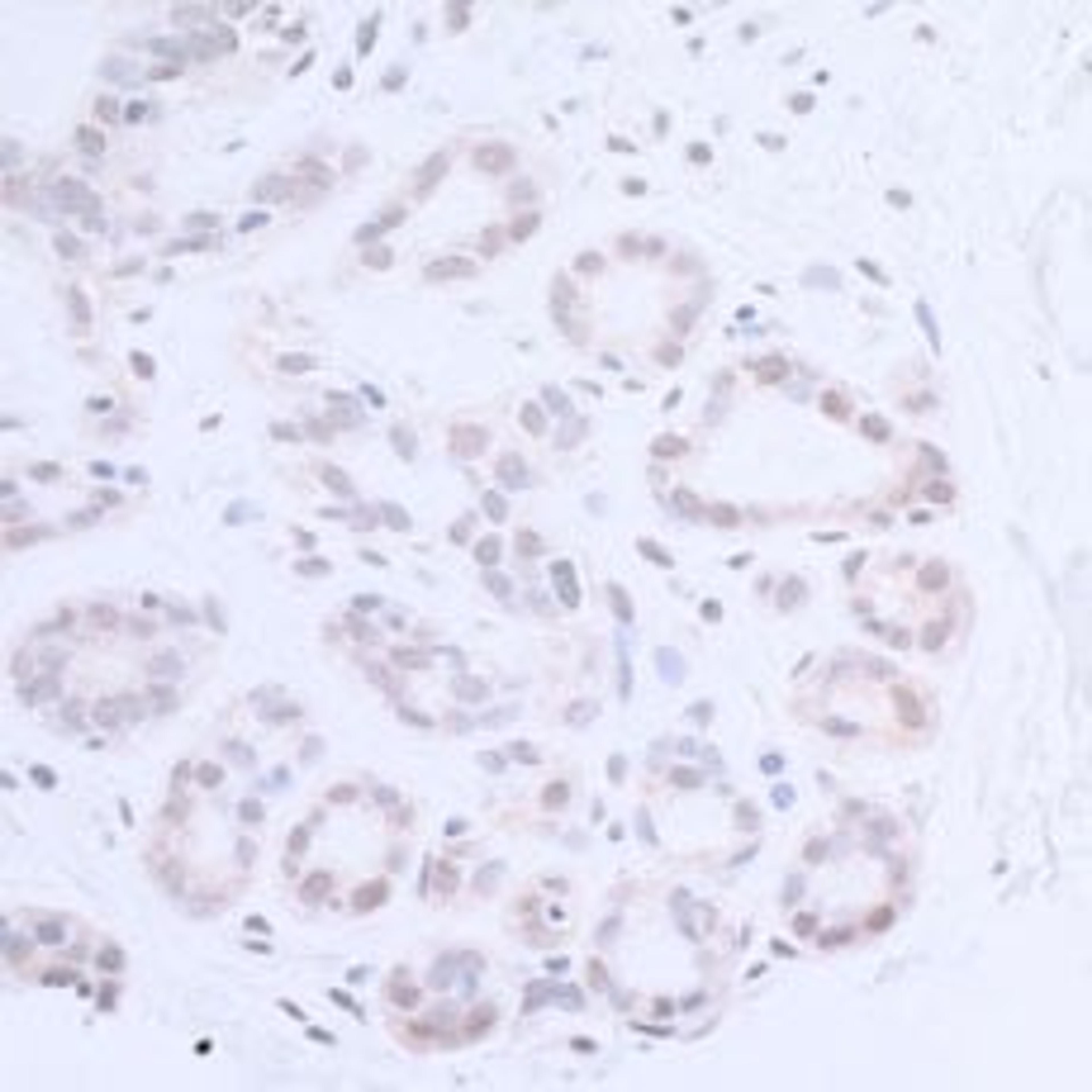 Detection of human XPA by immunohistochemistry.