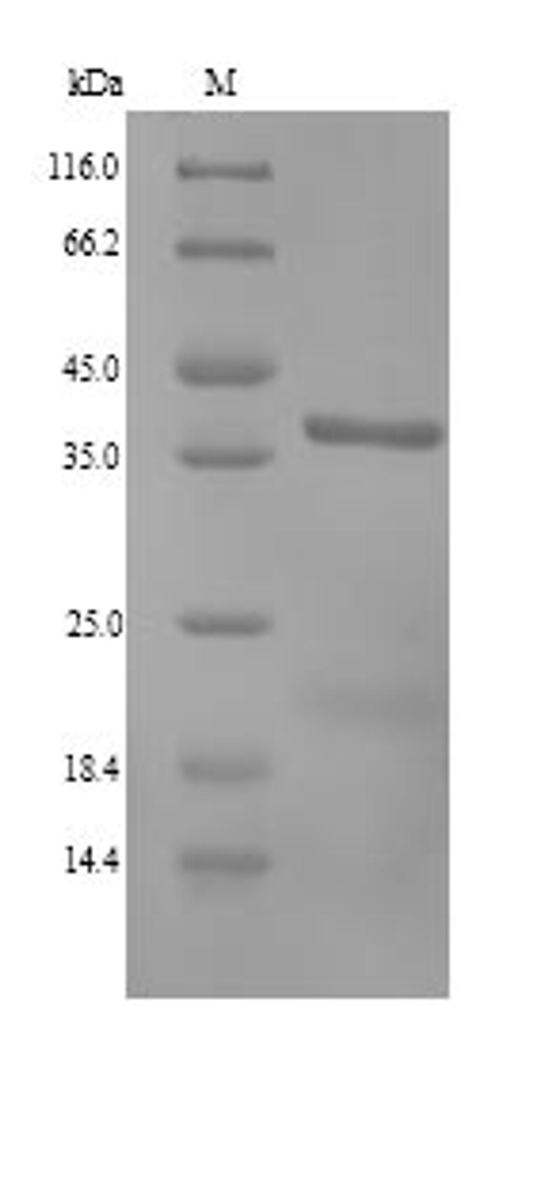 (Tris-Glycine gel) Discontinuous SDS-PAGE (reduced) with 5% enrichment gel and 15% separation gel.