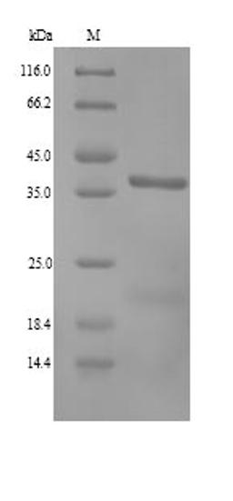 (Tris-Glycine gel) Discontinuous SDS-PAGE (reduced) with 5% enrichment gel and 15% separation gel.
