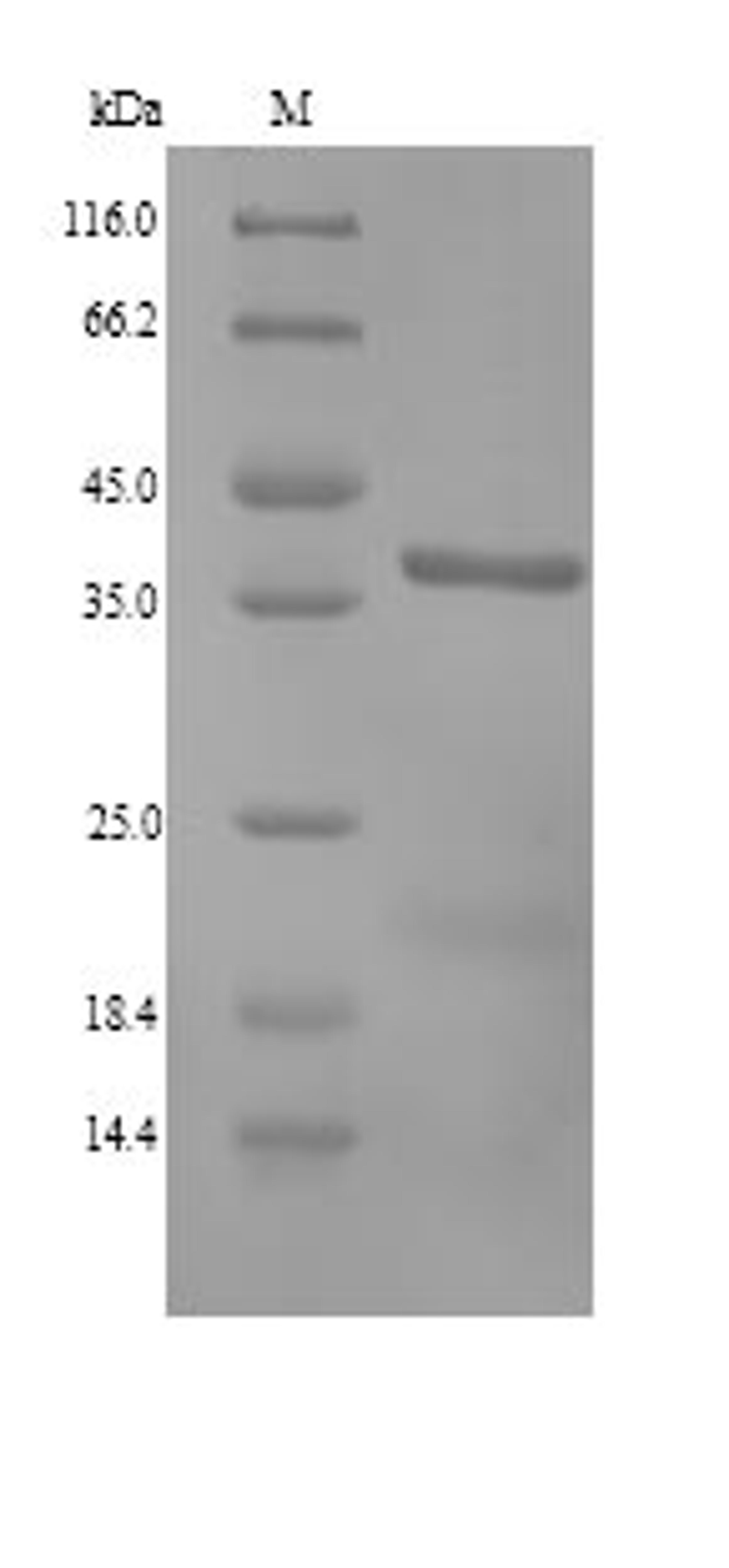 (Tris-Glycine gel) Discontinuous SDS-PAGE (reduced) with 5% enrichment gel and 15% separation gel.