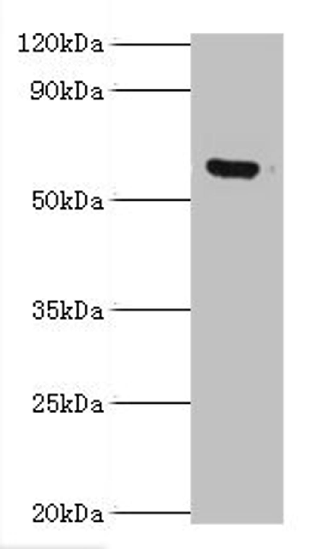 Western blot. All lanes: MKS1 antibody at 6ug/ml + Hela whole cell lysate. Secondary. Goat polyclonal to rabbit IgG at 1/10000 dilution. Predicted band size: 65, 60, 64 kDa. Observed band size: 65 kDa. 