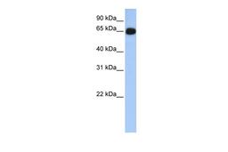 Antibody used in WB on Human Lung at 0.2-1 ug/ml.