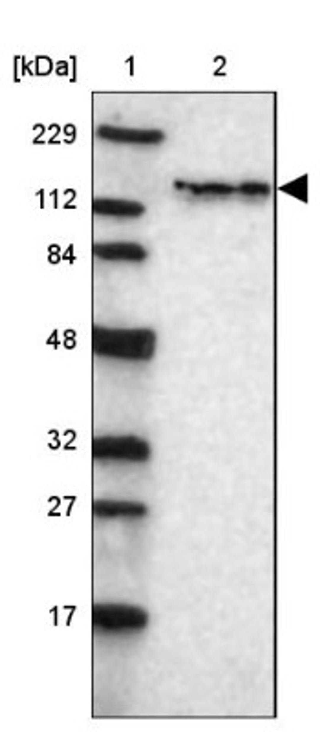 Western Blot: tyrosine kinase 2 Antibody [NBP1-87825] - Lane 1: Marker [kDa] 229, 112, 84, 48, 32, 27, 17<br/>Lane 2: Human cell line RT-4