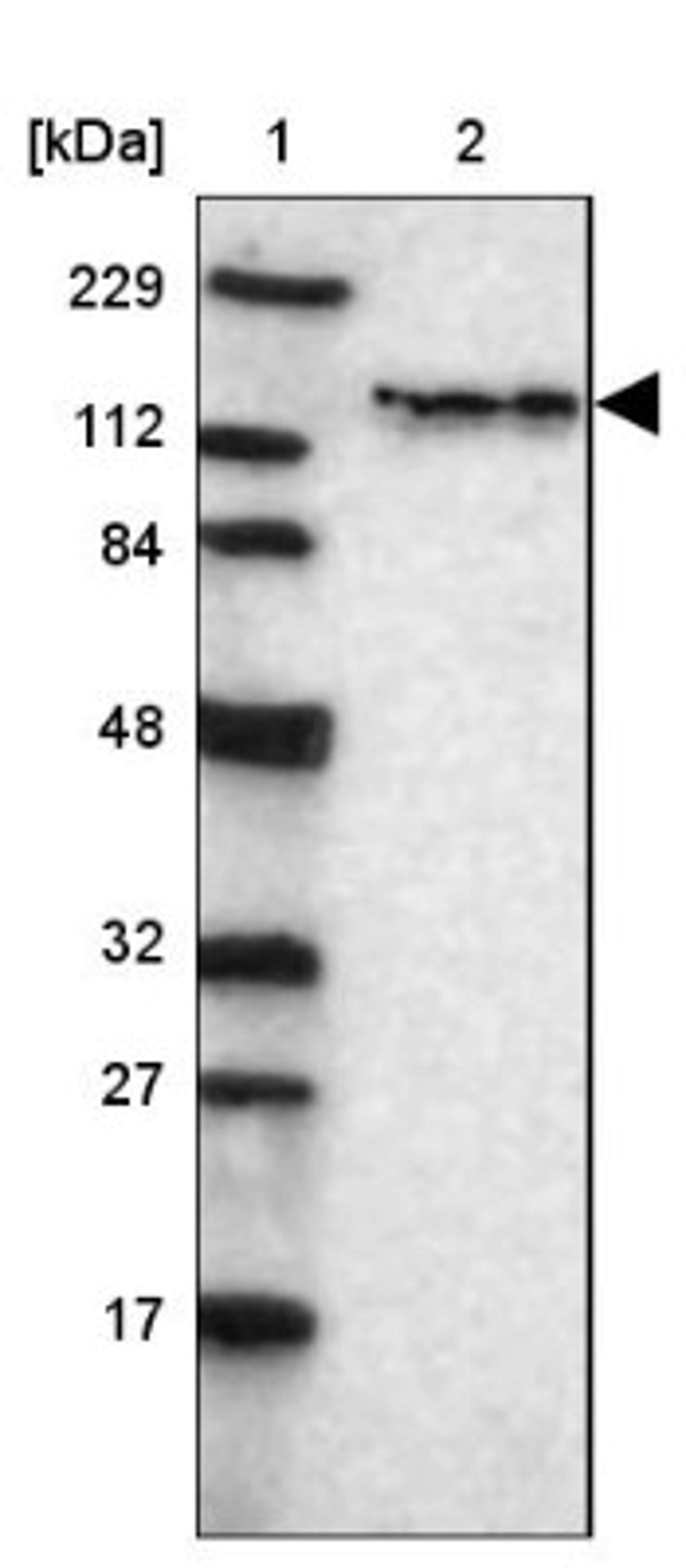 Western Blot: tyrosine kinase 2 Antibody [NBP1-87825] - Lane 1: Marker [kDa] 229, 112, 84, 48, 32, 27, 17<br/>Lane 2: Human cell line RT-4