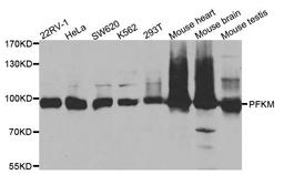 Western blot analysis of extracts of various cell lines using PFKM antibody