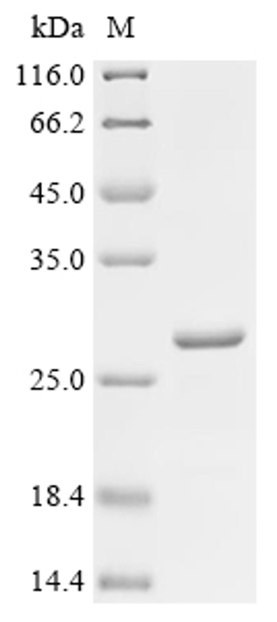 (Tris-Glycine gel) Discontinuous SDS-PAGE (reduced) with 5% enrichment gel and 15% separation gel.
