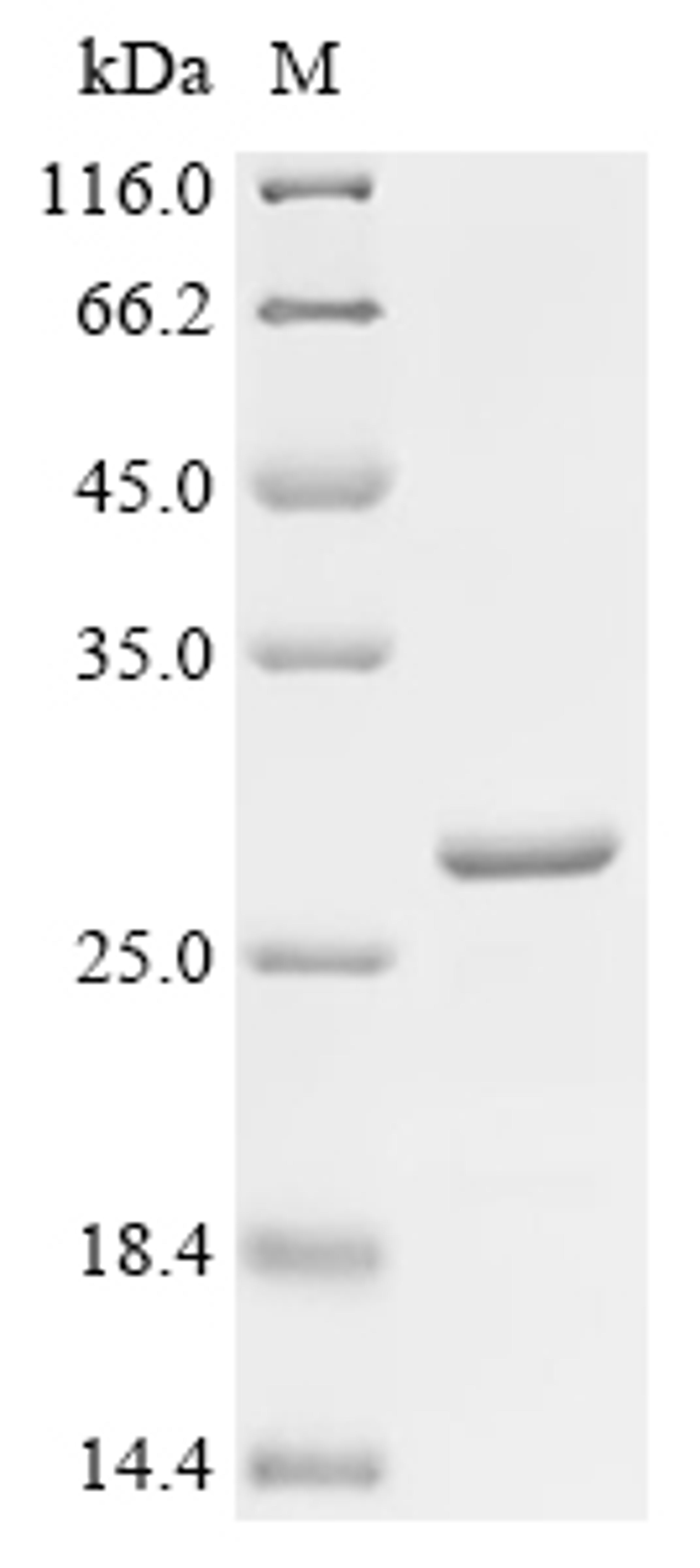 (Tris-Glycine gel) Discontinuous SDS-PAGE (reduced) with 5% enrichment gel and 15% separation gel.