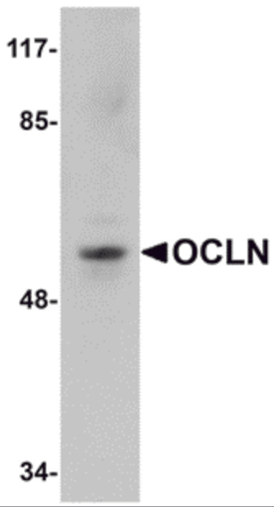 Western blot analysis of OCLN in human liver tissue lysate with OCLN antibody at 1 &#956;g/mL.