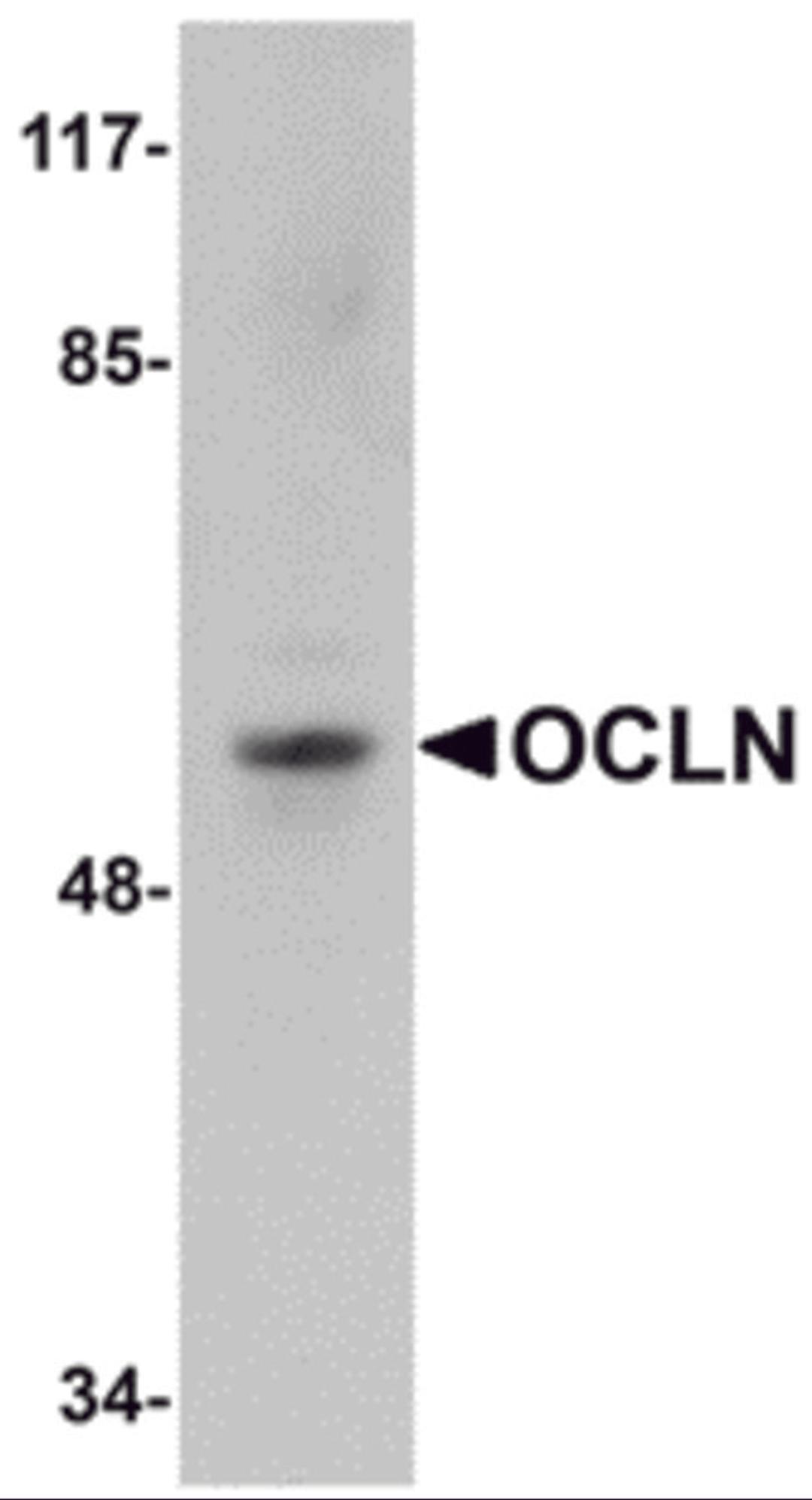 Western blot analysis of OCLN in human liver tissue lysate with OCLN antibody at 1 μg/mL.
