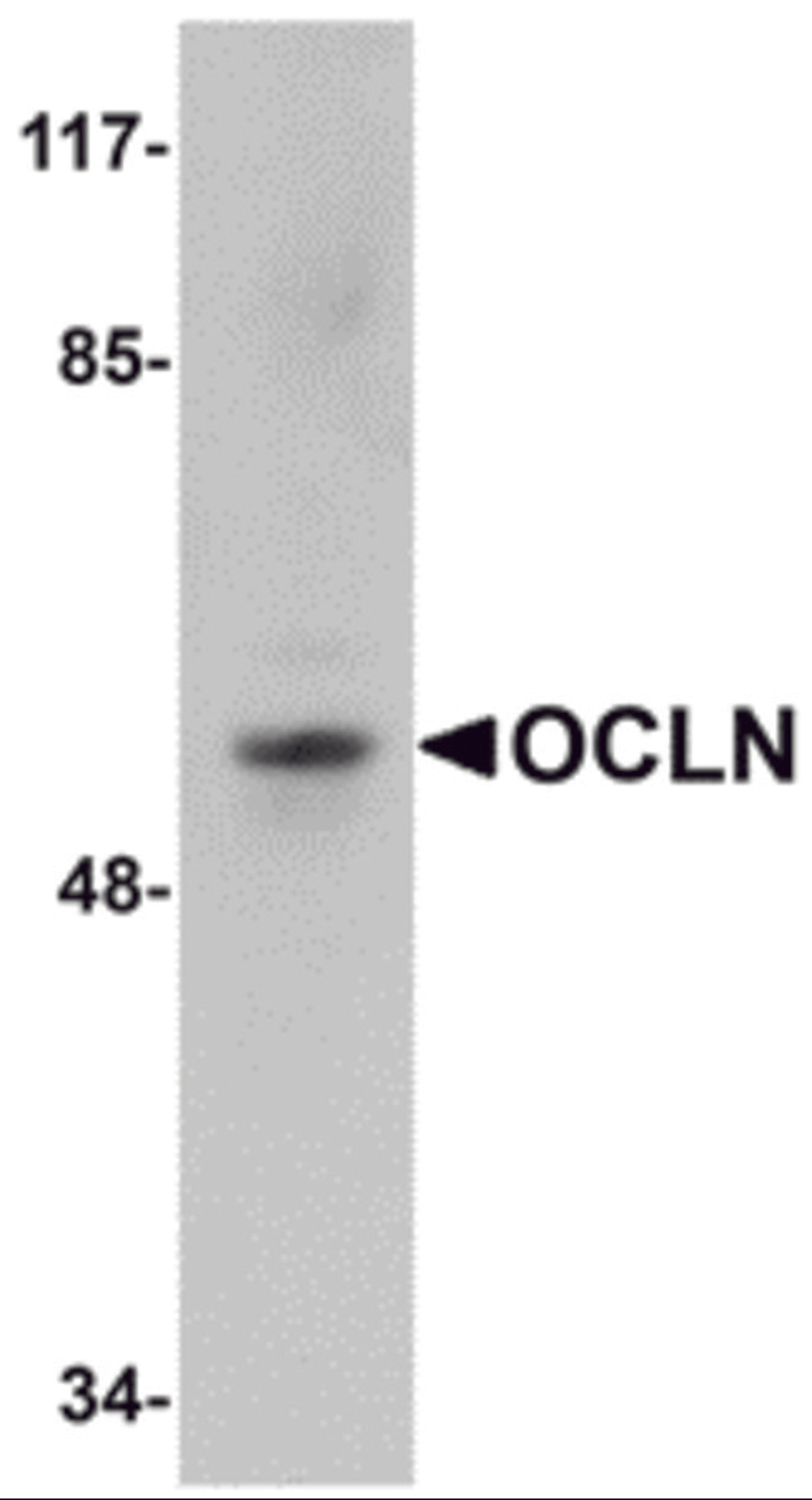 Western blot analysis of OCLN in human liver tissue lysate with OCLN antibody at 1 μg/mL.