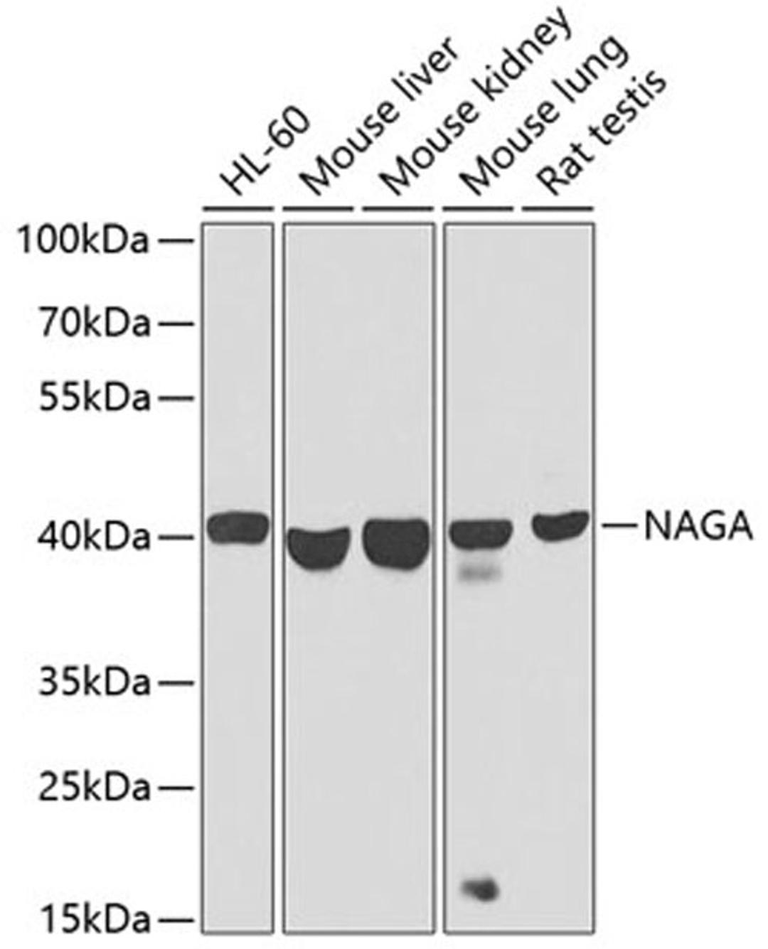 Western blot - NAGA antibody (A9942)