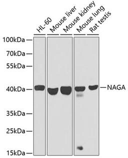 Western blot - NAGA antibody (A9942)