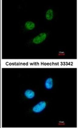 Immunocytochemistry/Immunofluorescence: MORF4L2 Antibody [NBP2-15022] - Paraformaldehyde-fixed HeLa, using antibody at 1:200 dilution.