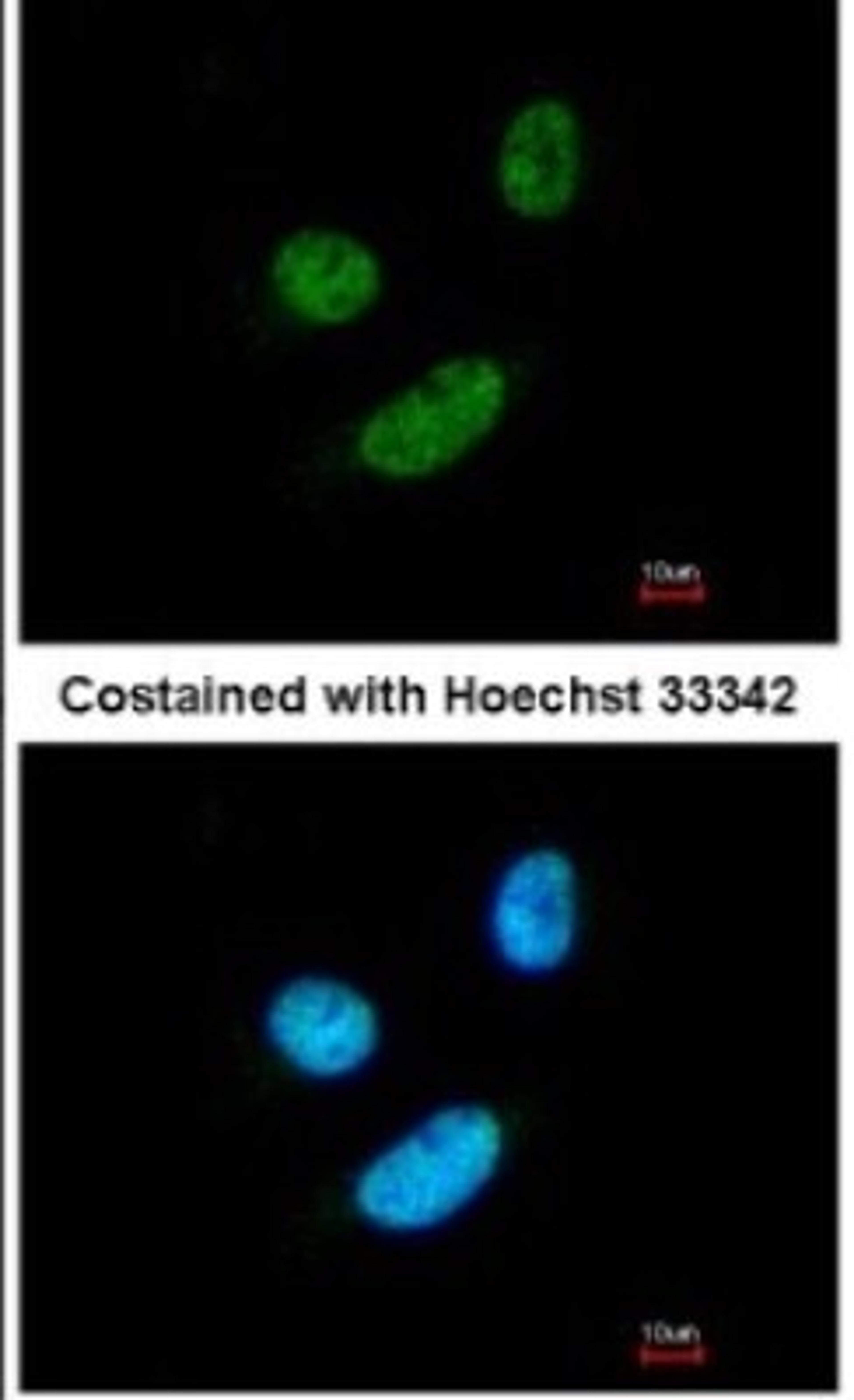 Immunocytochemistry/Immunofluorescence: MORF4L2 Antibody [NBP2-15022] - Paraformaldehyde-fixed HeLa, using antibody at 1:200 dilution.