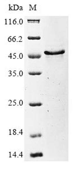 (Tris-Glycine gel) Discontinuous SDS-PAGE (reduced) with 5% enrichment gel and 15% separation gel.