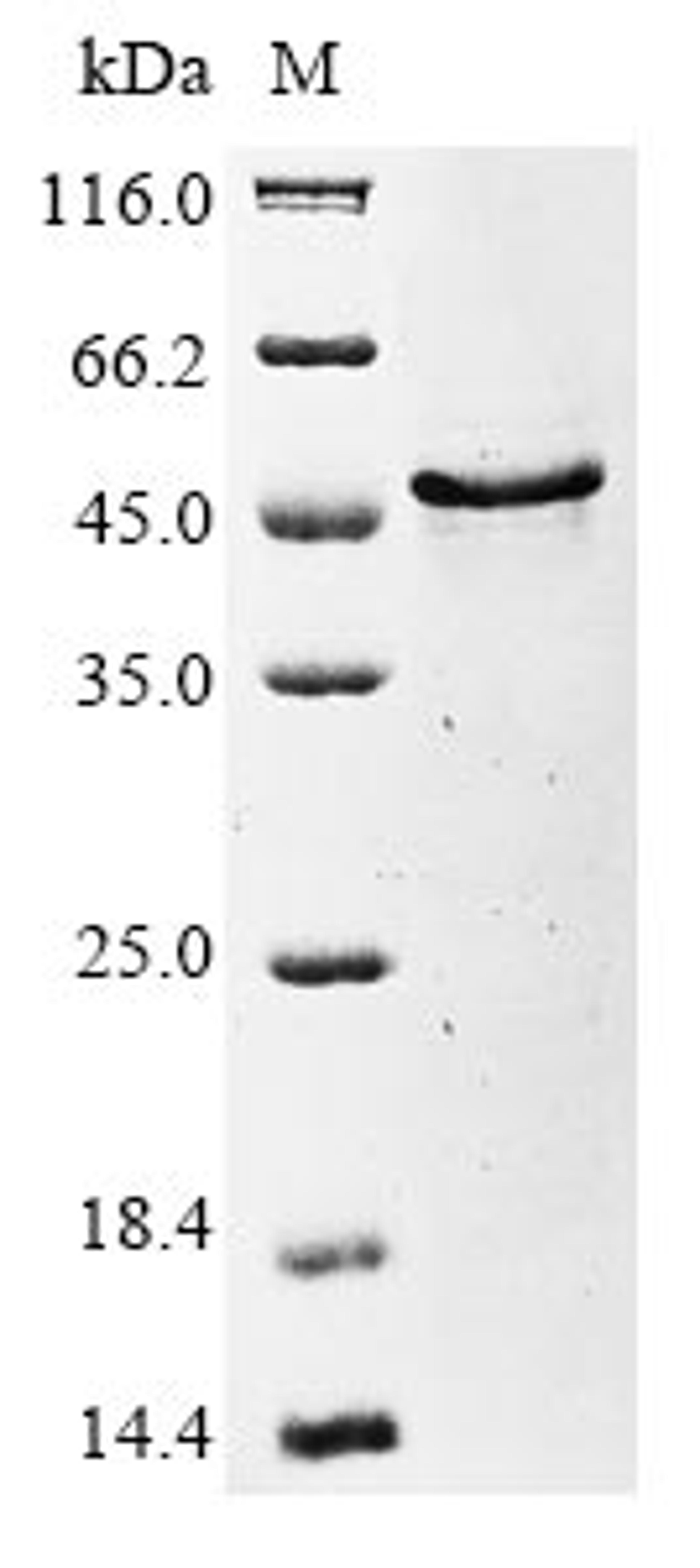 (Tris-Glycine gel) Discontinuous SDS-PAGE (reduced) with 5% enrichment gel and 15% separation gel.