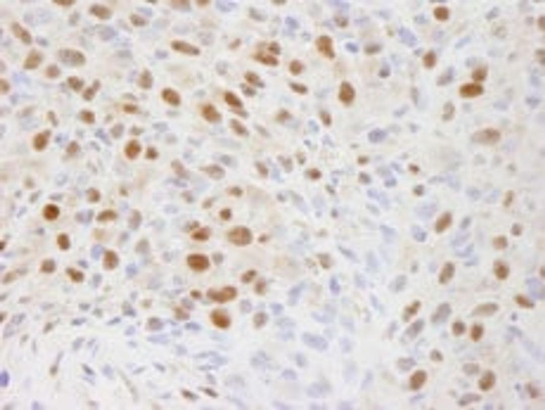 Detection of mouse EFTUD2/SNRP116 by immunohistochemistry.