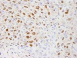 Detection of mouse EFTUD2/SNRP116 by immunohistochemistry.